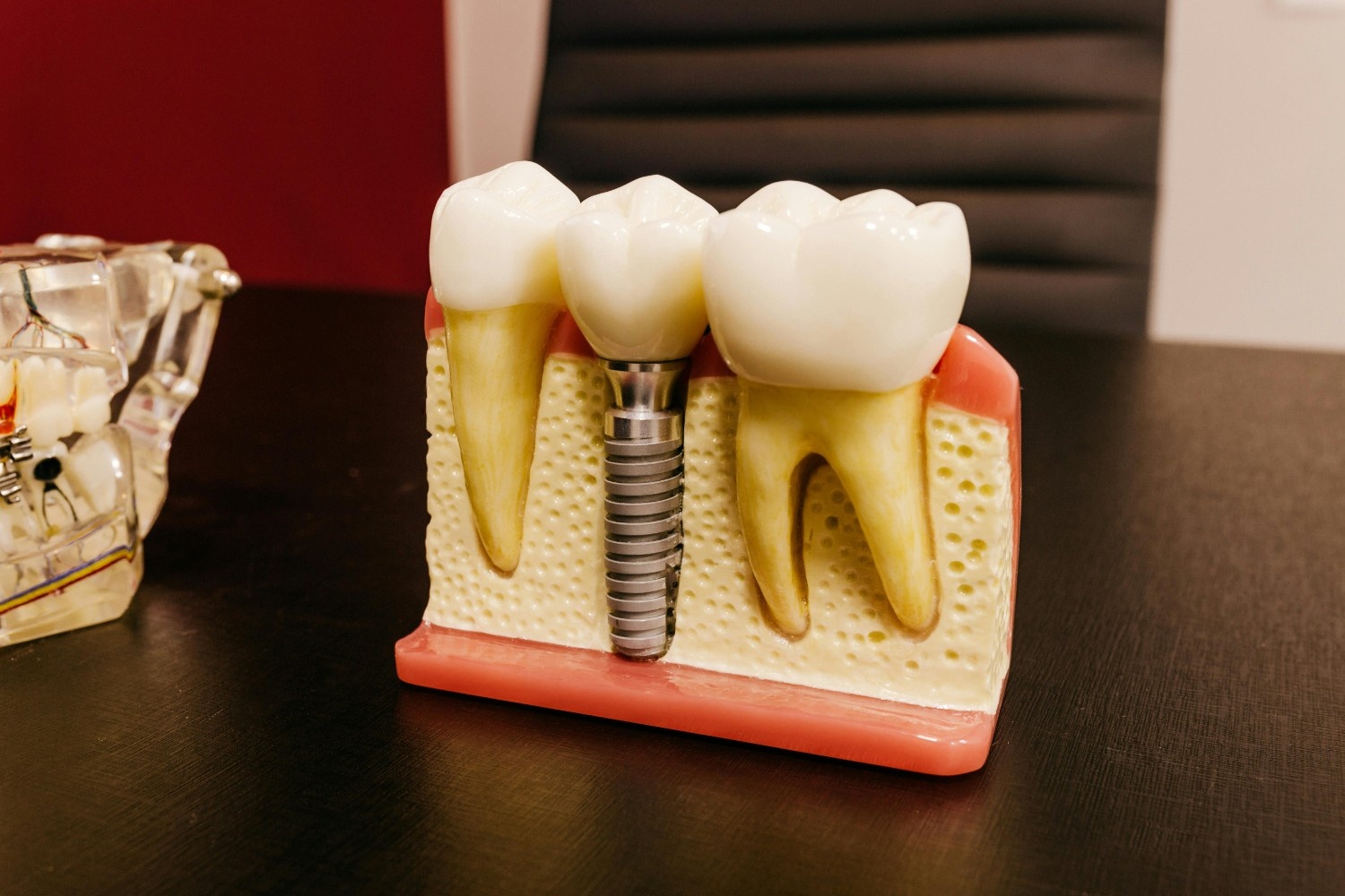Implant Procedure